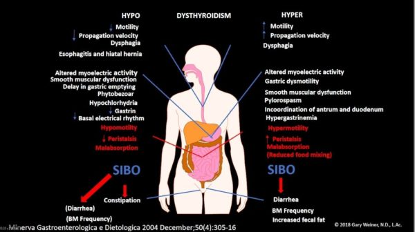 Thyroid MMC SIBO Connection Masterclass 1