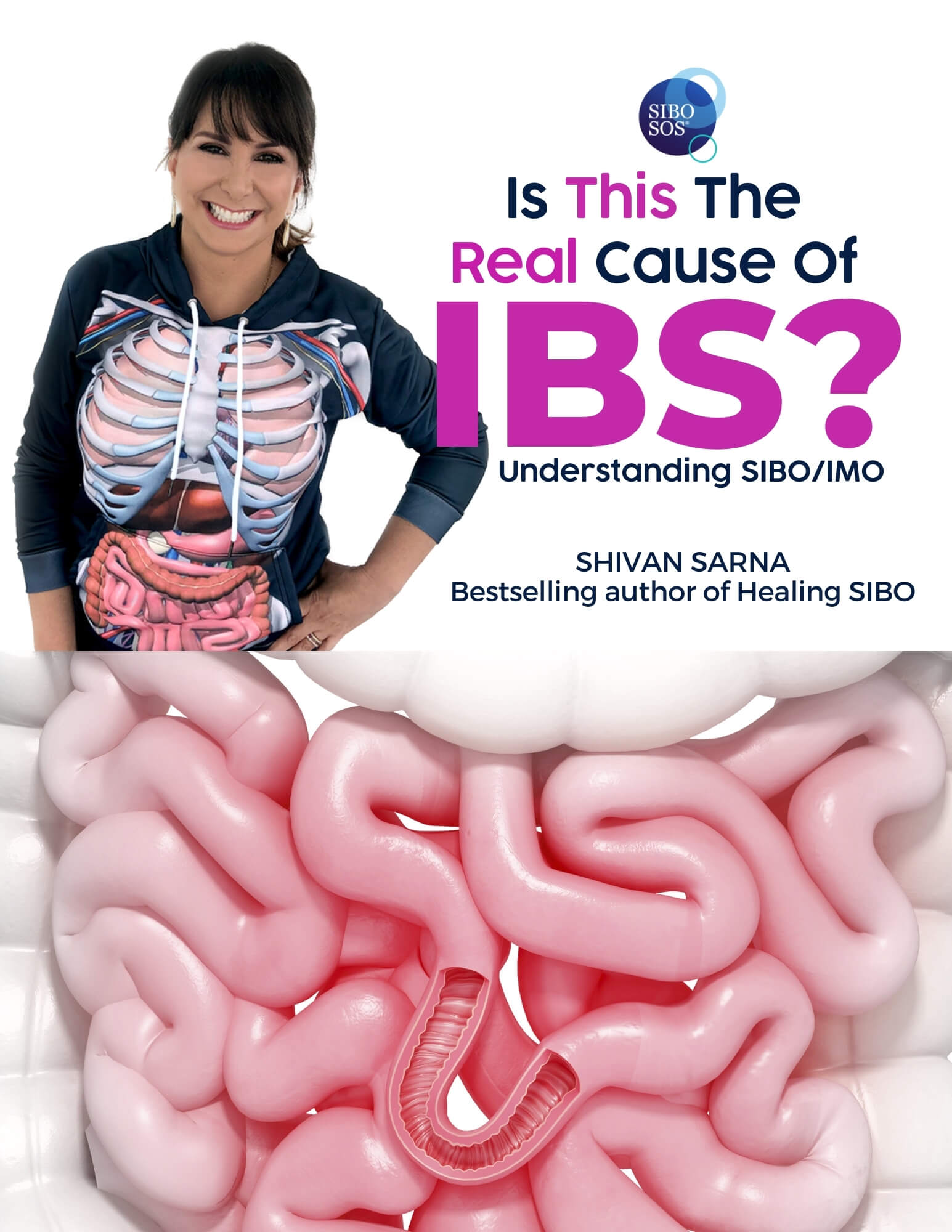 SIBO SOS IBS Ebook
